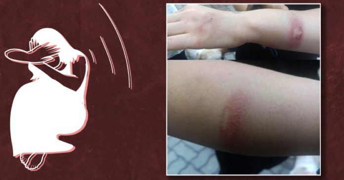 chinese woman beaten up in noida