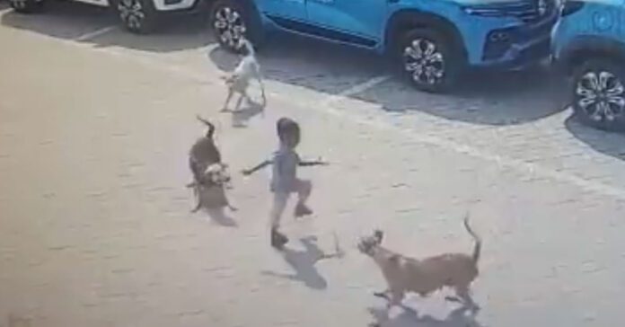 4-years-old-boy-street-dogs-attack